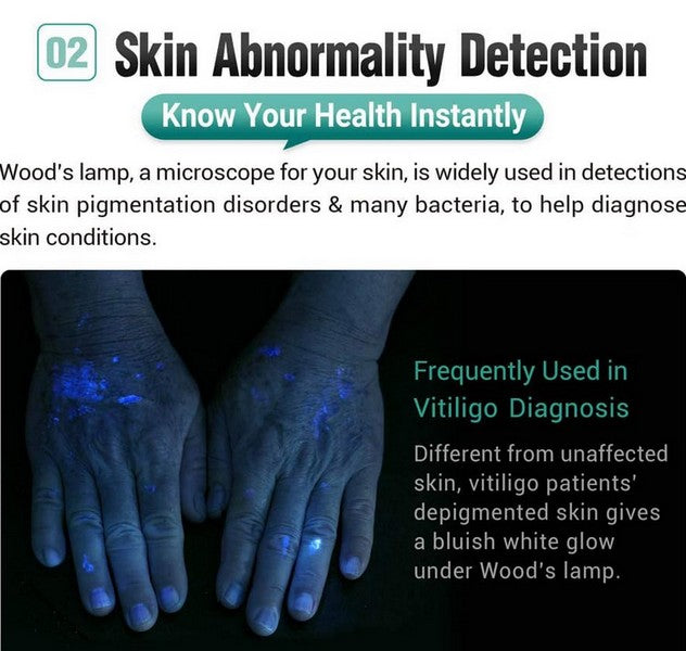 Dr.K3 UV - Lampe stylo médicale ultraviolet - 365 Nanomètres - 600mW